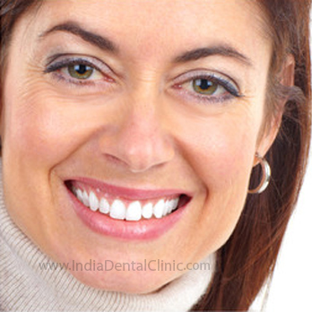 Image for Dental Offer ceramic veneers