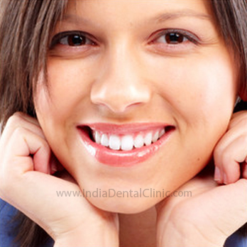 Image for Dental Offer Smile Makeover with Dental Veneers