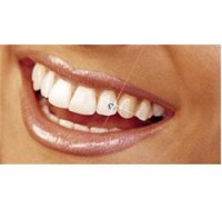 Dental Treatment image of 32 Stars Dental Clinic