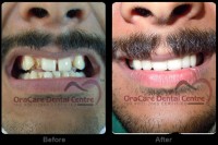 Dental Treatment image of Oracare Dental Centre