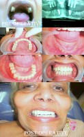 Dental Treatment image of Shraddha Dental Care