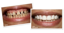 Dental Treatment image of Kapoor Dental Clinic And Implant Centre