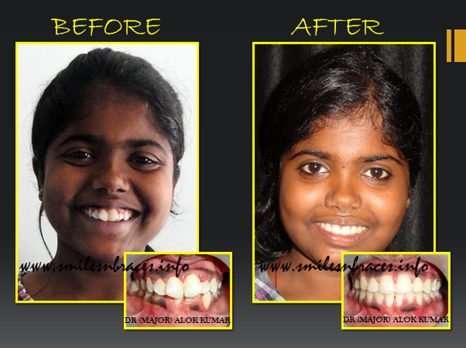 Dental Treatment image of Smiles N Braces Orthodontic Care Centre