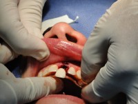 Dental Treatment image of Pearl Dentistry