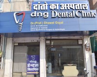 Dental Treatment image of Dng Dental Clinic | Best Dental Implant Jaipur | Best Dentist Jaipur | Best Dental Clinic Jaipur