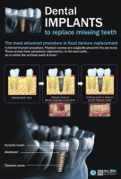 Dental Treatment image of Jhansi Dental Care