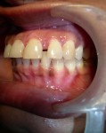 Dental Treatment image of Gupta Dental Clinic & Orthodontic Centre